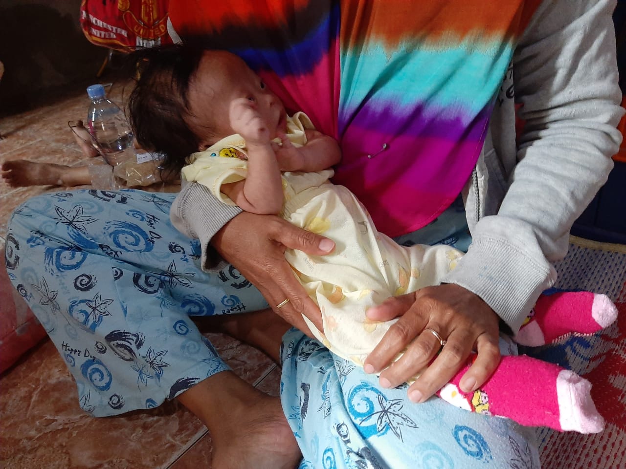 Dirawat di RSUD Depati Hamzah, Bayi 3 Bulan Itu Karena Menderita 3 Penyakit Ini